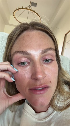 Latisse made my eyes red — what to do next