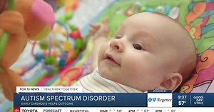 Recognizing early signs of autism