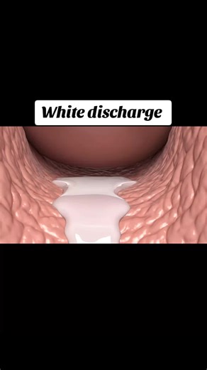 Understanding White Discharge During Menstruation