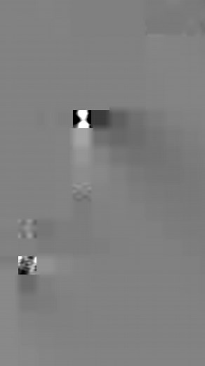 5.6K views · 125 reactions | Tooth Morphology & Anatomy | Incisors | Root Anatomy | 3D Animation | Dental Daily | Facebook