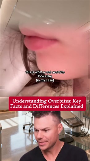 This video explains the differences between overbite and overjet, showcasing a real example of a severe deep bite. Learn about the importance of proper dental terminology and how braces can correct bite alignment! #overbite #dentistry #orthodontics #braces #dentalhealth #teethalignment