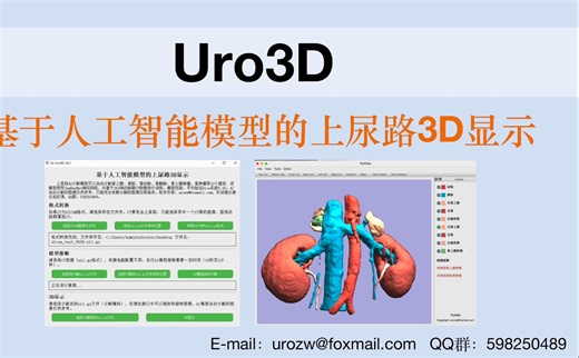 【Uro3D】基于人工智能的上尿路3D显示工具，一键三维可视化CT图像（2024年6月，基于MONAILabel）