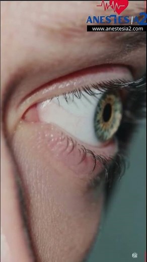 What type of anesthesia is used in eye surgery? #medicalfacts #trivia