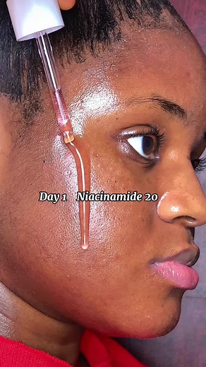 Choosing Between 10% and 20% Niacinamide Serums