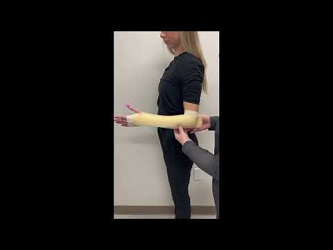 How to Fabricate a Muenster Orthosis (The Best Way to Fabricate a Muenster Orthosis!)