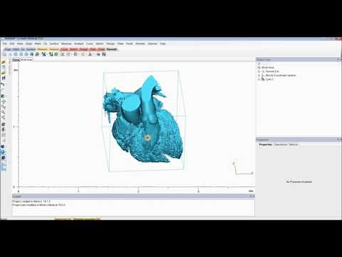 Tutorial: Mimics Innovation Suite - Create a Heart Model for 3D Printing