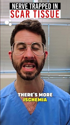 What Scar Tissue Does to Your Nerves