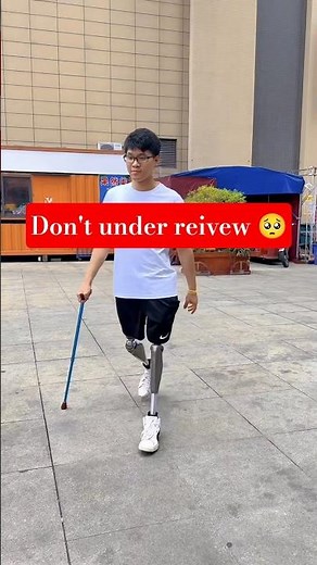 Using Prosthetic Limb Like a Pro | Real Life Video