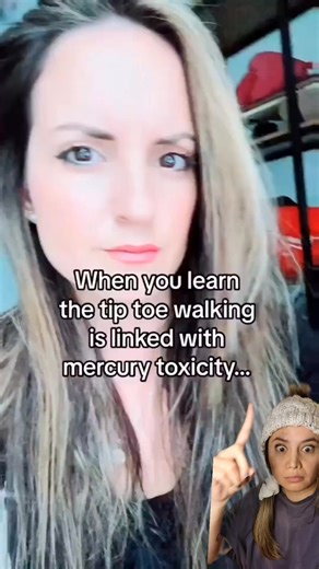 Signs of MERCURY TOXICITY in the kids. Mercury has beeSignsn found in baby foods tested in America (search heavy metals in baby foods) the air--yes "ambient air" a direct quote from a pub med study, as well as umbilical cord blood. Mercury toxicity is linked to developmental delays as well as learning disabilities in children. This Momma used a safe heavy metal detox to help support her toddler and he learned 50 new words in two weeks an INCREDIBLE story! #toddlermom #sahmlife #crunchymom #natur