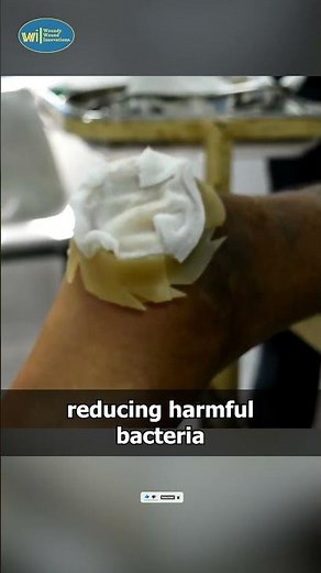 How Maggot Therapy Works. #advancedwoundcare #science #woundcare #medicaleducation