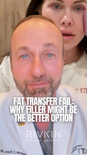 Alexander Rivkin, MD on Instagram: "When we talk about facial fat transfer vs. dermal fillers, it’s important to understand one key difference: fat grafting is surgery. Surgical facial fat transfer can create beautiful results in the right hands and in the right patient, but it is also inherently less predictable. Swelling can last longer than expected, volume can settle unevenly, and once fat survives, it is not easily reversible. That lack of control can sometimes lead to a persistently puffy