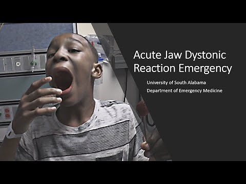 Acute Jaw Dystonic Reaction Emergency