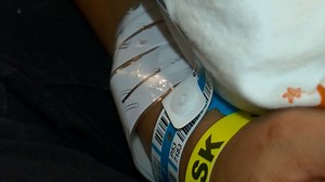 Genetic testing during woman's pregnancy leads to a life-saving discovery