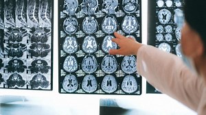 Why the human brain grew so large, explained by science