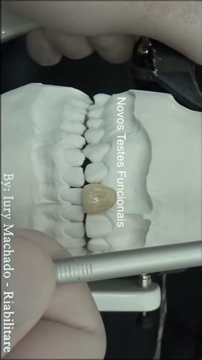 ENCERAMENTO que Vende o Tratamento. #dentista