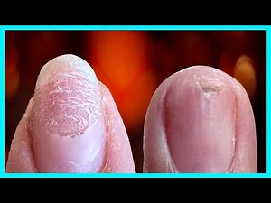 🛑STOP DAMAGING Your Natural Nails! TRY My Proven Technique