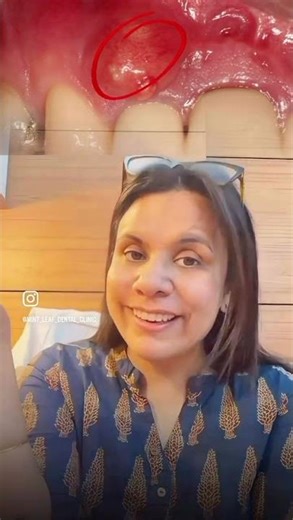 Wisdom Tooth Pain ? Think again !!