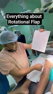 Everything about Rotational Flap| Dr. Kulkarni - Plastic Surgeon
