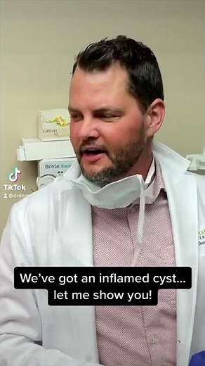 Inflamed Cyst
