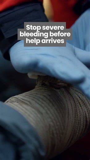 Mastering Bleeding Control in Emergencies