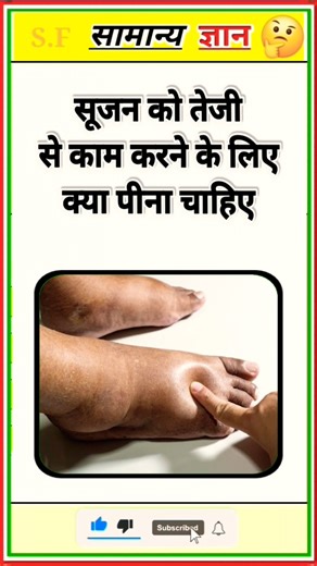 Top 50 ✍️ IAS Question 🔥💯🥰 Gk Question and Answer Part- 155 #gkFacts #staticgk #bkgkstudy #gkinhindi