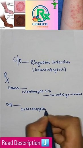 Ringworm infection treatment