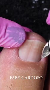 14M views · 51K reactions | Cutilagem Masculina 禮 Materiais usados: Alicate 777 (usei pra cortar) Amolecedores Amolece (Líquido e creme) Alicate Staleks 10/7 na Cutilagem Palito Isis Cutelaria | Faby Cardoso | Facebook