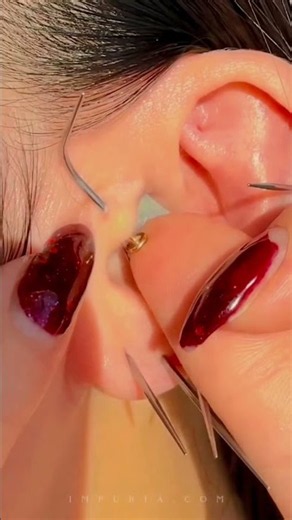 ✨ Beautiful Ear Piercing Transformation