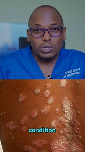 204K views · 1.7K reactions | Eczema vs psoriasis #kihuga #thw #TheHealthWise #healthwise #medical #viralreel | The HealthWise | Facebook