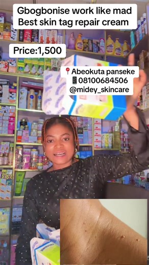 Best Skin Tag Removal Cream in Abeokuta