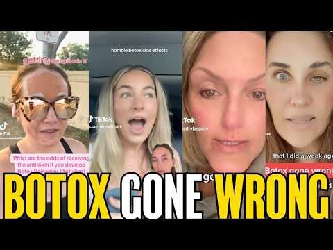 The Dark Side of Botox: The Risks No One Warns Women About