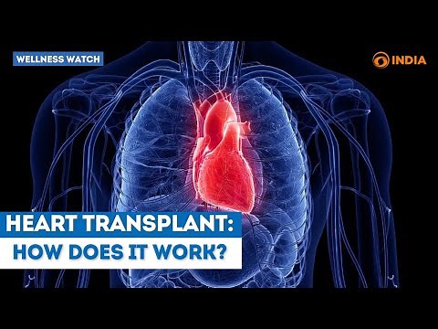 Heart Transplant: How does it work? | Wellness Watch