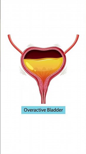 Why You’re Peeing So Often — 5 Common Causes Explained | 5 Main Causes of Frequent Urination