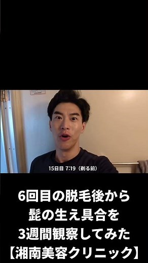 I tried beard hair removal at Shonan Beauty Clinic! 3-week record #shorts