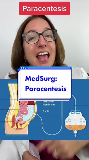 Understanding Paracentesis: Procedure, Techniques, and Nursing Care
