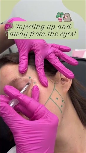 Injecting Up and Away From the Eye!