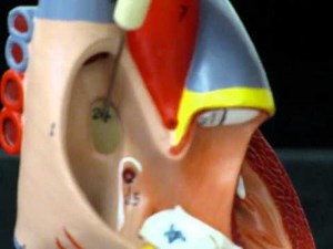 Small Heart Model-Fetal Circulation Remnants AP2