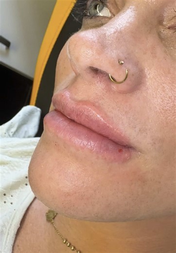 Lumi Pro Lip Booster: Achieve Luscious Lips Now!