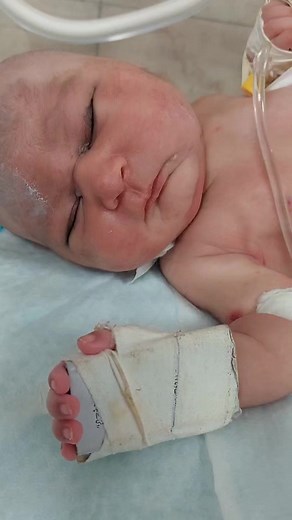 A baby called microcephaly #baby #ontrending #infant #babygirl #babyshower #microcephaly #newborn #babiesoftiktok #infants | Hidden medical lifehack