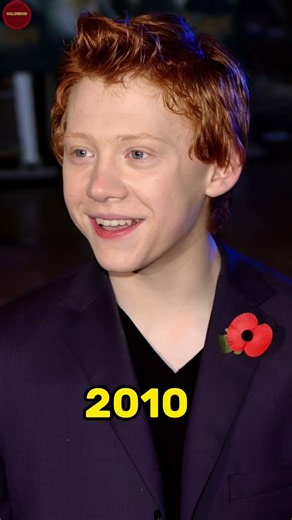 ✨ Rupert Grint's Incredible Transformation 😍 | Then vs Now (2001–2026) ❤️‍🔥 | From Icon 🌟 #shorts