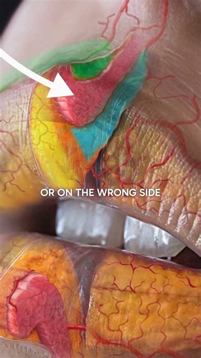 This is how to stop lip filler migration