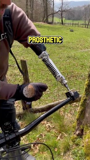 Prosthetic Arm Hack Shocks Cyclists Everywhere👀