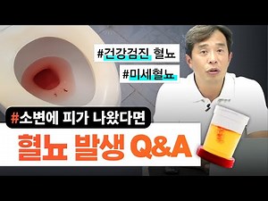 소변에 피가 나왔다면! 혈뇨 발생 Q&A #건강검진혈뇨#미세혈뇨 - 서울대 전문의