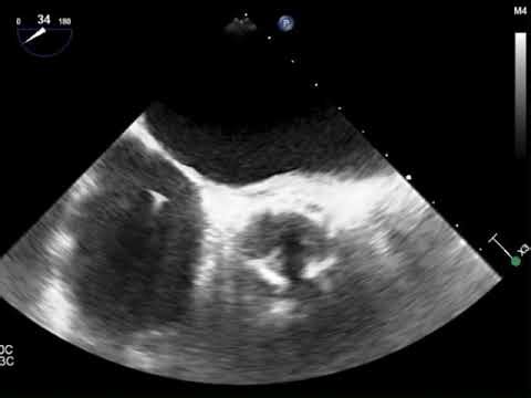 Q2 (71) prosthetic valves