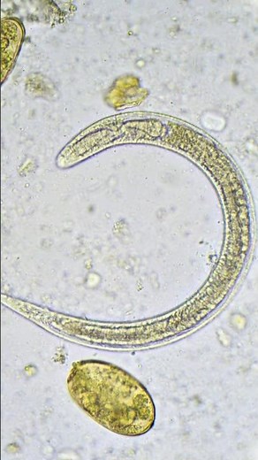 Snake in a Golden Flower Field? Nope, It’s a Nematode! #science #microscope #nature #biology