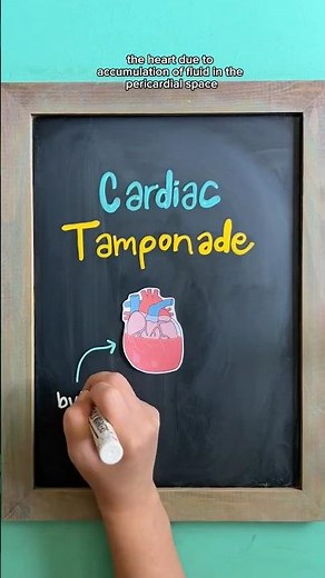 CARDIAC TAMPONADE #nursingstudents