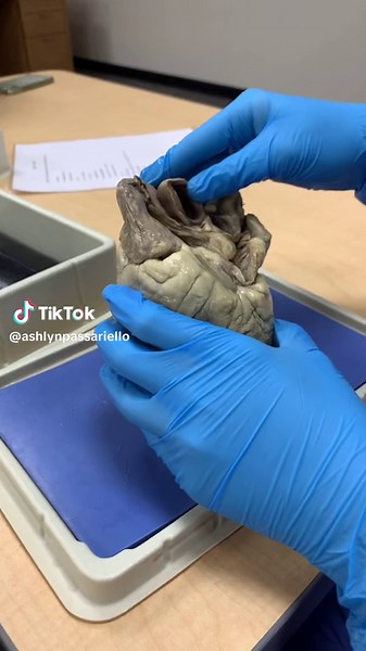 Understanding Human Heart Anatomy: A Surgical Perspective