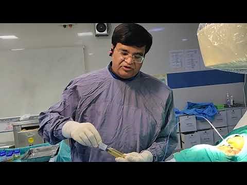 Video for Public: Pericardial Tapping (removal of Fluid accumulated around Heart) is a life saving