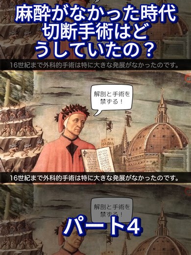 麻酔がなかった時代、切断手術はどうしていたの？｜切断手術の歴史と麻酔薬の革命！