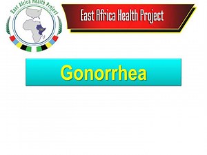 PPT - Gonorrhea PowerPoint Presentation, free download - ID:3427141